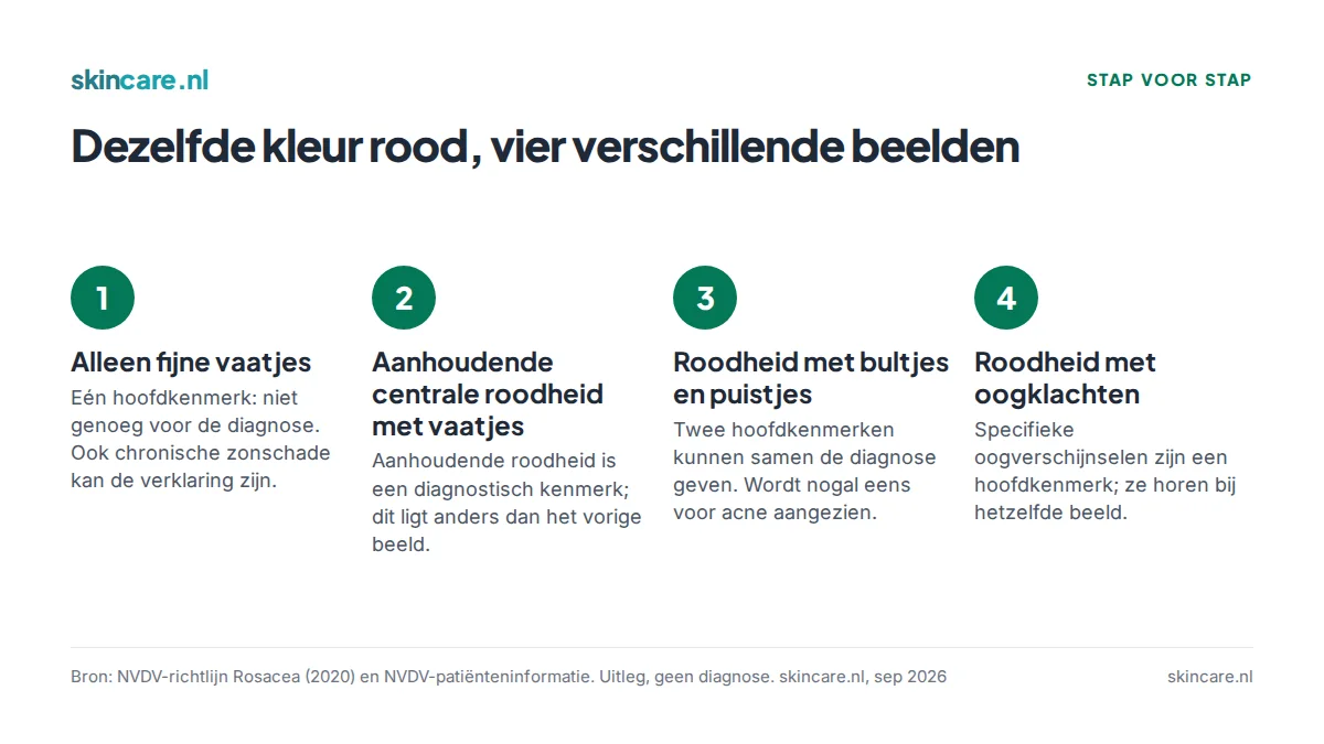 Vier situaties met roodheid in het gezicht en wat de richtlijncriteria daarover zeggen