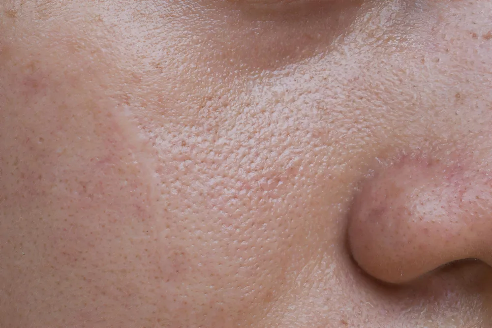 Poriën kunnen ze kleiner