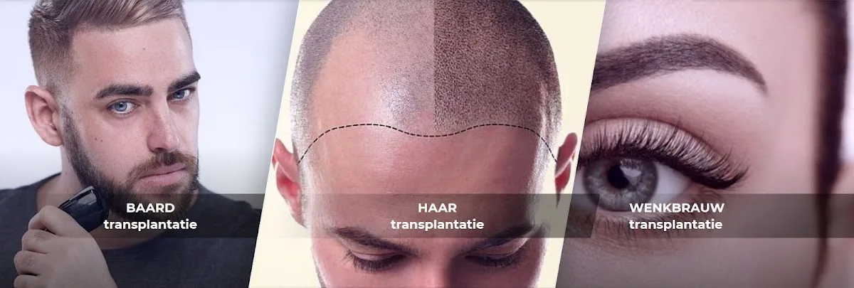 123 Haartransplantatie Turkije