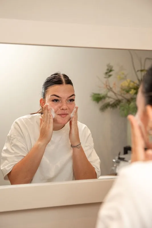 Acne Advies
