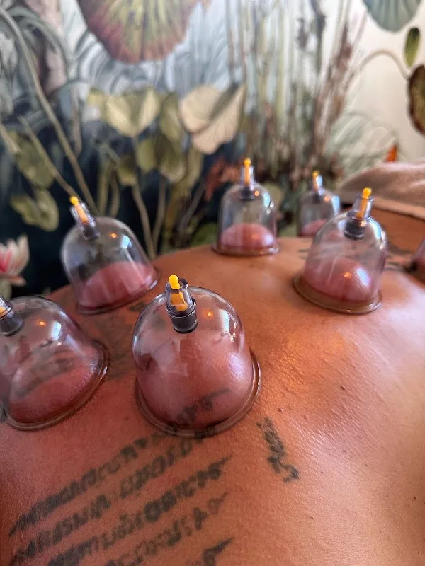 Balance by Cupping