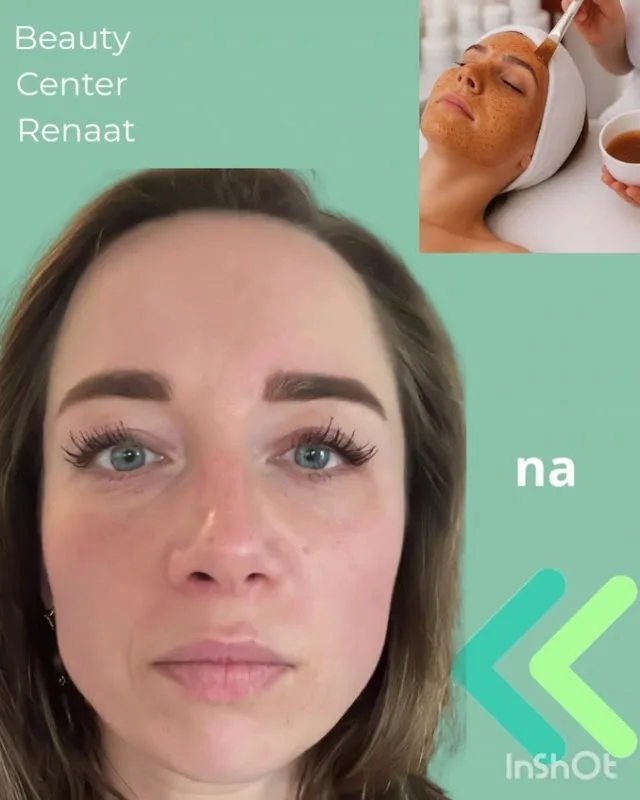 Beauty Center Renaat | Schoonheidssalon Ede