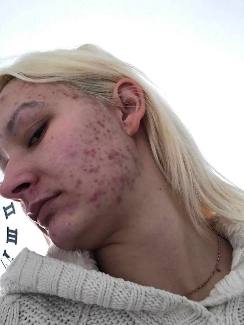 DermaBliss