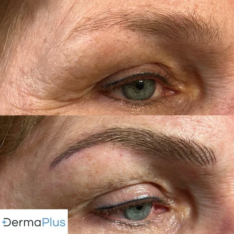 DermaPlus