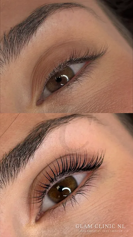 Glam Clinic NL