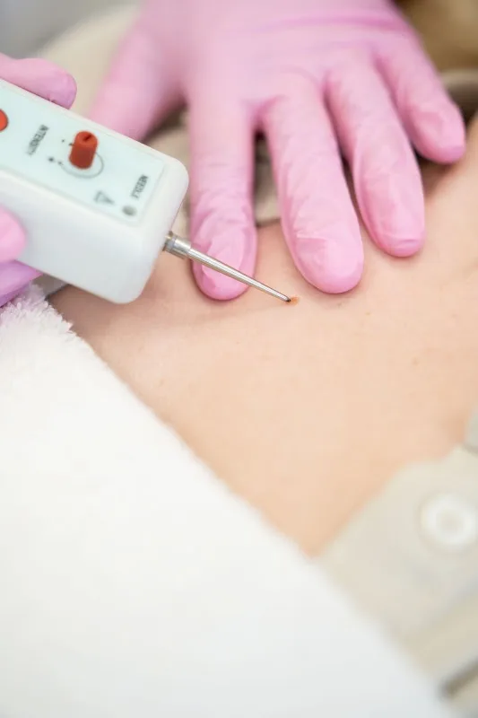 Huidkliniek de Vallei