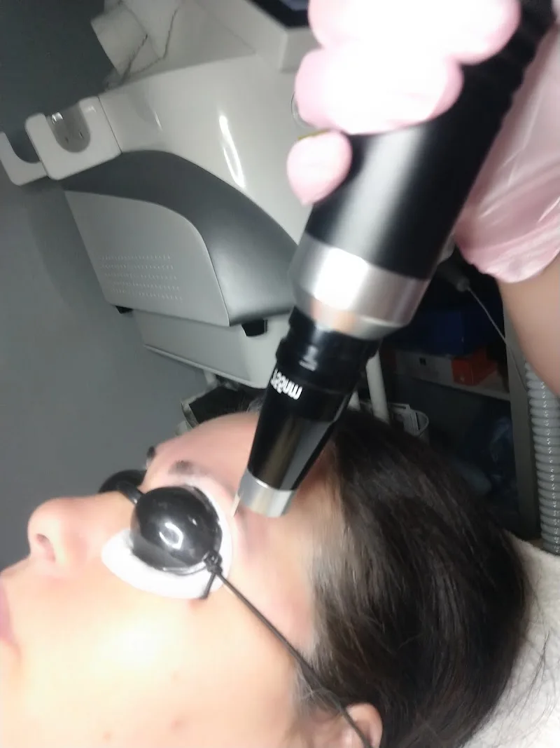 Laserbehandelingen enschede