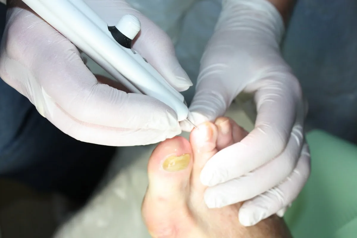 Medisch Pedicure by An