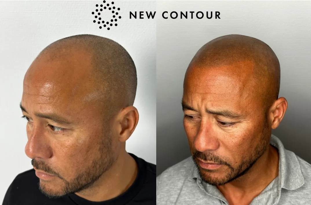 New Contour
