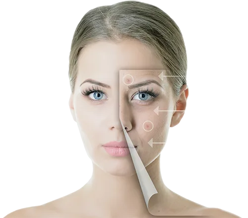 passie huidverbetering