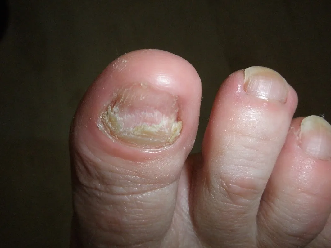Pedicure Hillegom Footfit