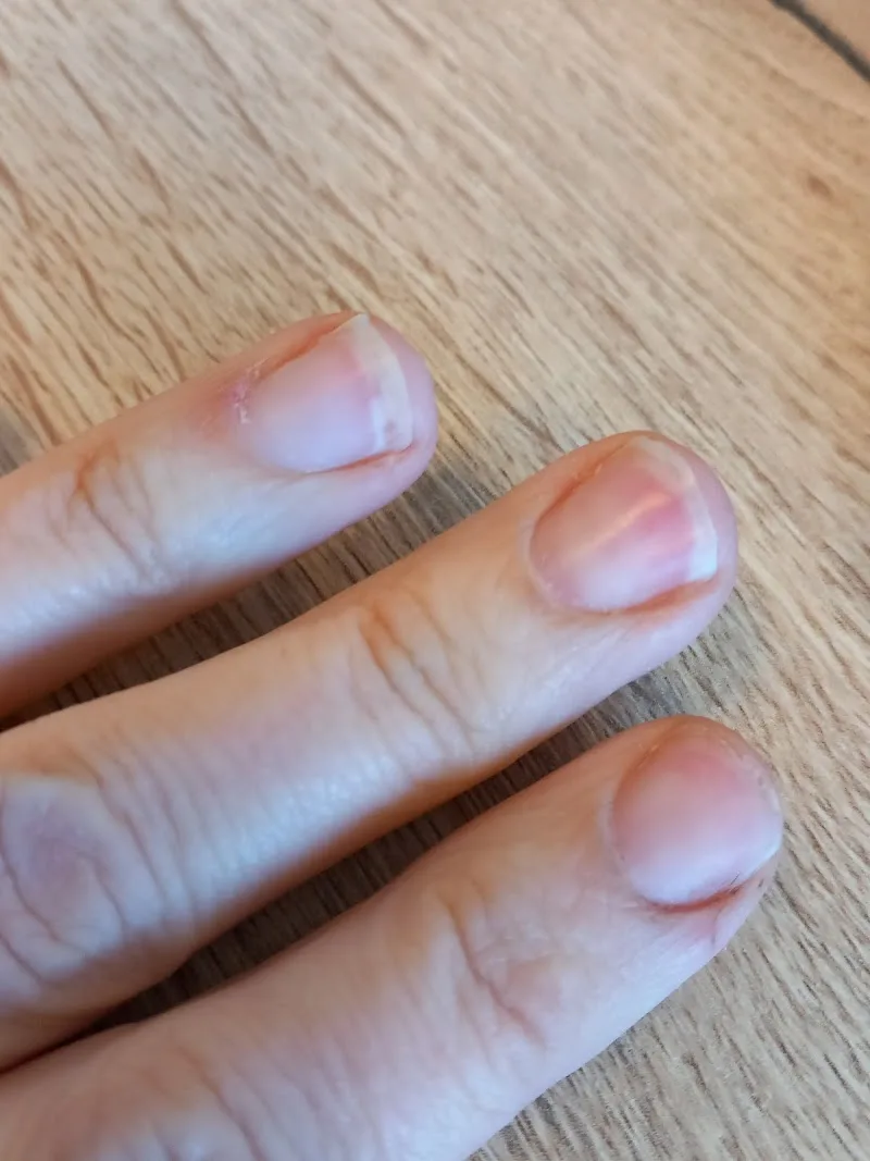 Uniek Nagel-Rose - Leiden